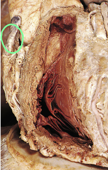 <p>What is circled?</p>