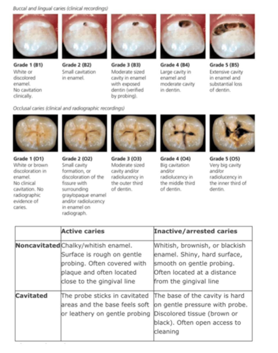 <p>review Cavitated/Non-cavitated Caries chart</p>
