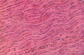 <p>Protection made of Collagenous makes up tendons ligaments and the while of eyeball , not well vesicularized</p>