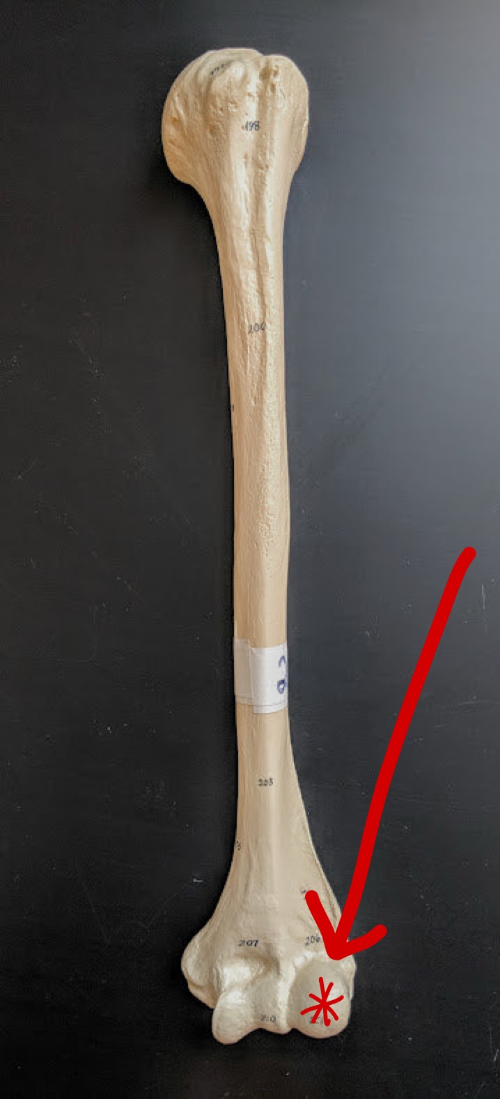 <p>Name this structure</p>