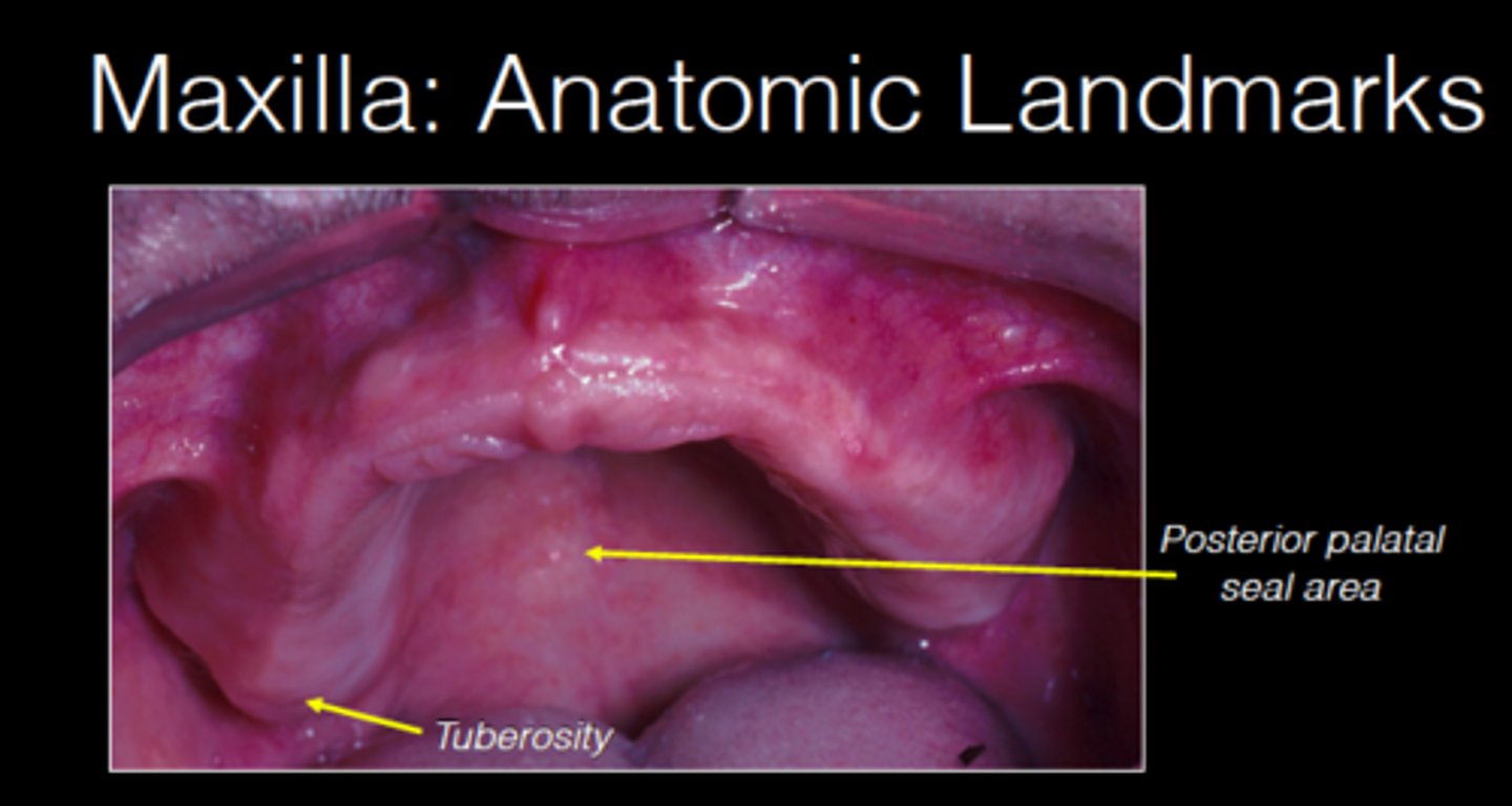 <p>distal to the junction of the hard and soft palate at the vibrating line</p>