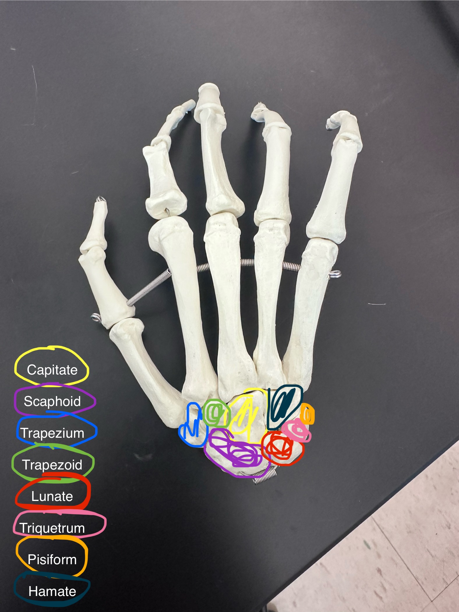 <p>Scaphoid</p>