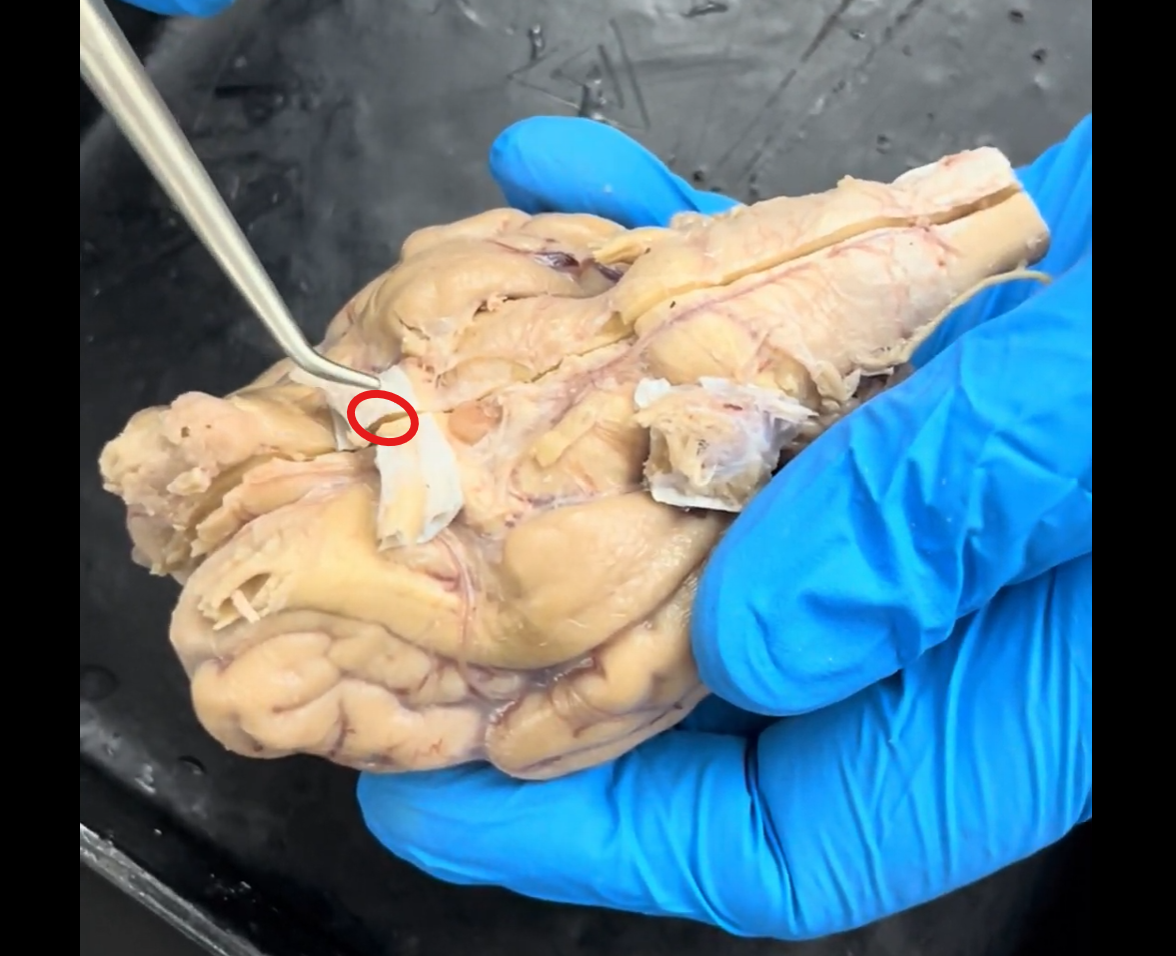 <p>Name the part of the brain within the red circle that the probe is pointing to.</p>