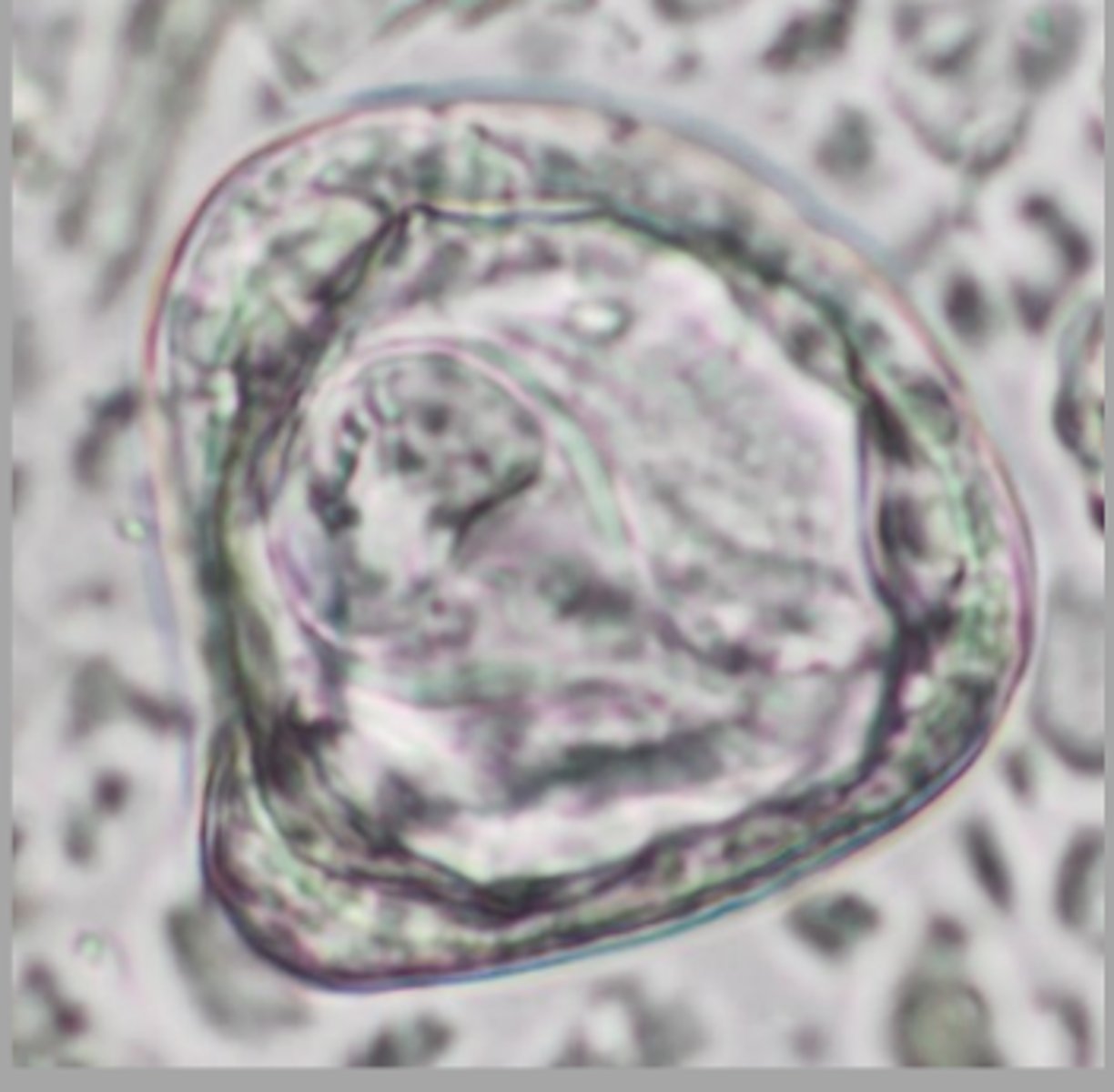 <p>Eggs like the one pictured were found on a horse fecal. The horse was grazing on rocky scrubby pasture. How did the horse become infected?</p>