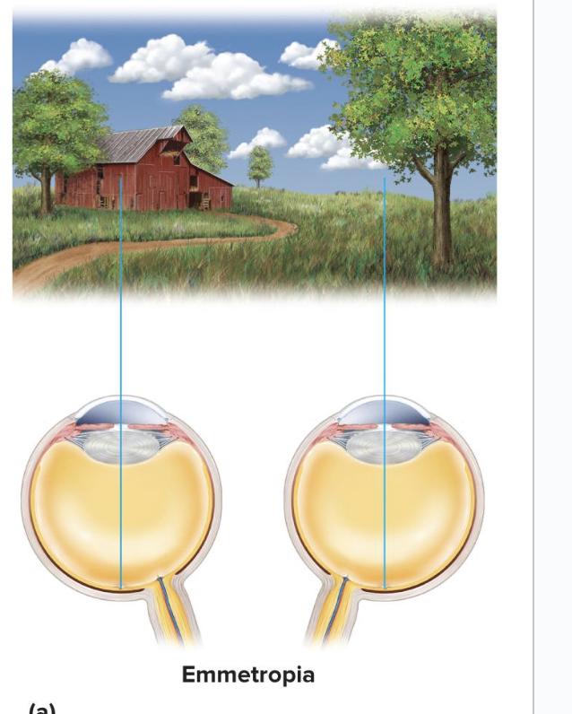 <p>state in which the eye is relaxed and focused on an object more than 6 m (20 ft) away</p><ul><li><p>Light rays coming from that object are  parallel, so we can dilate without damage</p></li><li><p>Rays focused on retina without effort</p><ul><li><p>Light rays coming from a closer object are too divergent to be focused without effort</p></li></ul></li></ul><p></p>