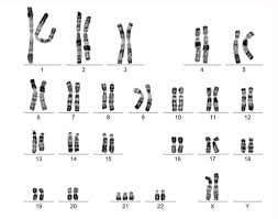 <p><strong>an individual's complete set of chromosomes</strong><span>. Also refers to a lab-produced image of a person's chromosomes arranged in numerical order</span></p>