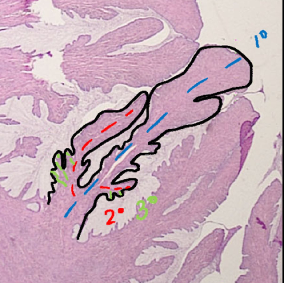<p>true/false: the cervix contains longitudinal mucosal folds. These include primary folds with secondary folds budding off of them and tertiary folds budding off of those.</p>
