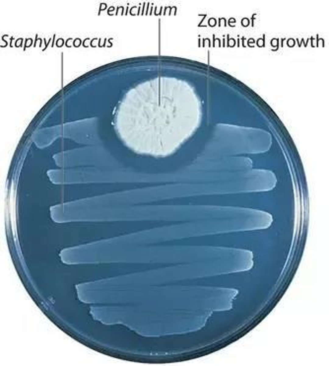 <p>Mold that produces the antibiotic penicillin.</p>