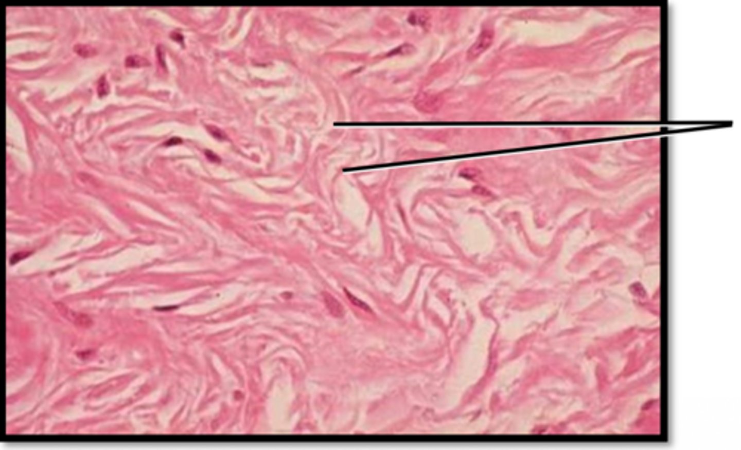 <p>Name this tissue</p>