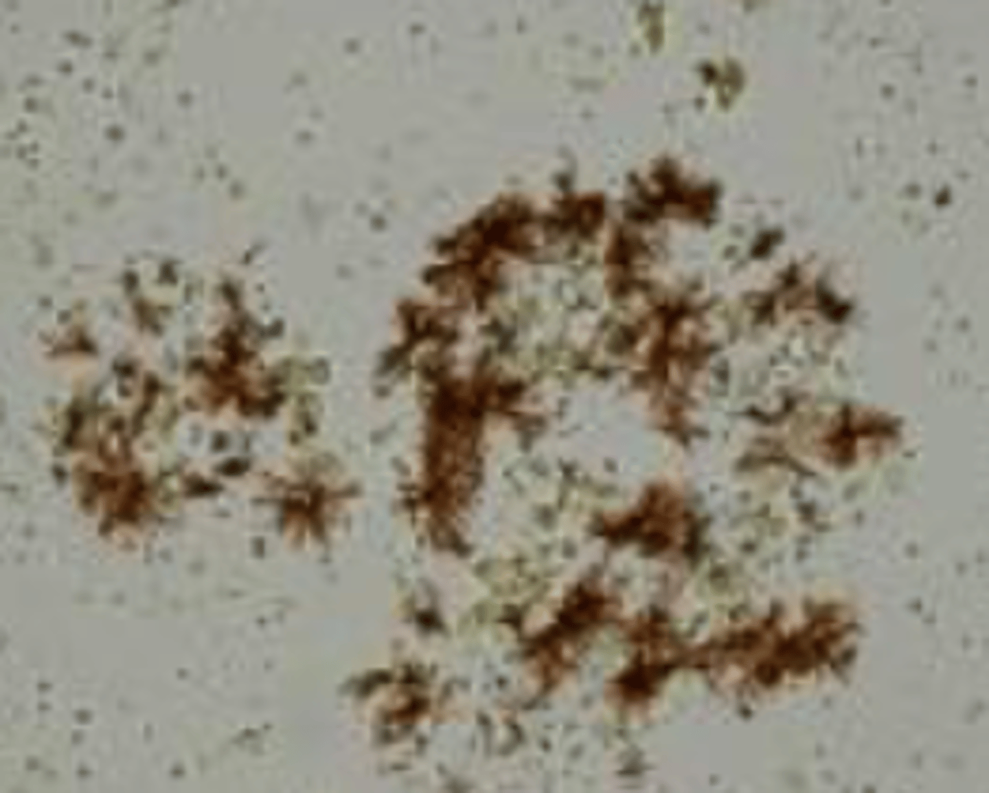 <p>- Shaped like branching needles, twigs, or antlers</p><p>- Amber/bourbon color</p><p>- Common in acidic urine</p><p>- Not normally a concern</p>