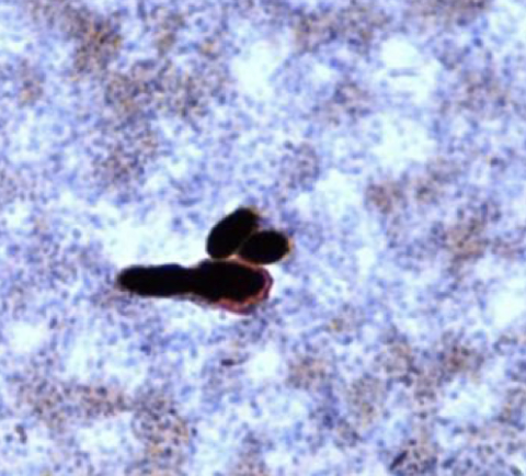 <p>Fusarium spp.</p>