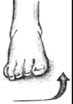 <p>movement of ankle in frontal plane with sole of foot rotating inward</p>
