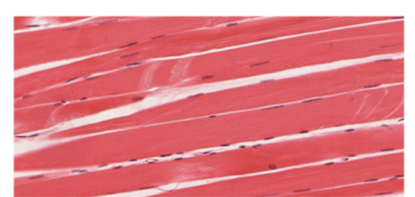 <p>Prominent striation and nuclei on their periphery</p>