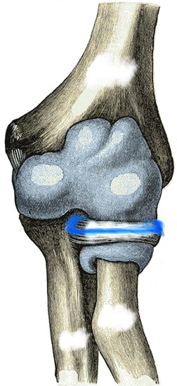 term image