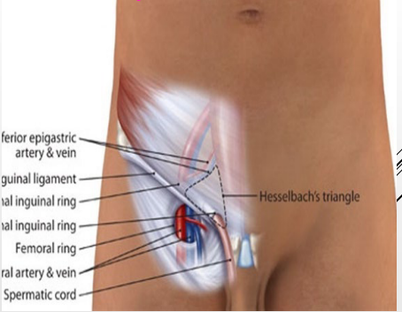<p><strong>Femoral Ring (Medial Compartment)</strong></p><p>-Femoral ______, weak area where the abdomen contents meet the thigh </p><p>-Anterior border → _______ ligament </p><p>-Medial border → ________ ligament </p><p>-Lateral border → _________ vein</p><p>-Posterior border → _________ ligament and pectineus muscle </p>
