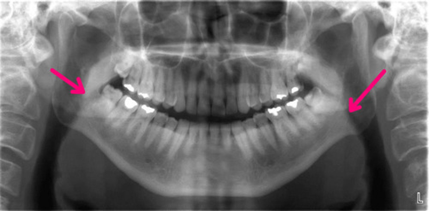 <p>Identify radiolucent structure.</p>