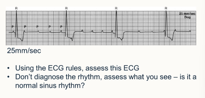 <p>Using ECG rules, assess this ECG</p><ul><li><p>assess what you can see</p></li><li><p>is it normal sinus rhythm</p></li></ul><p></p>