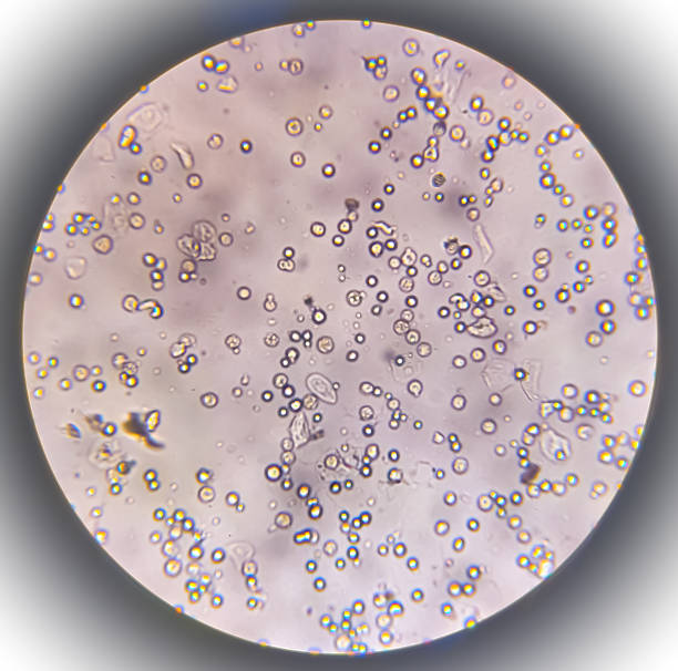 <p>biconcave, ghost cells</p>