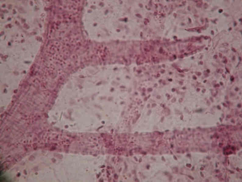 term image