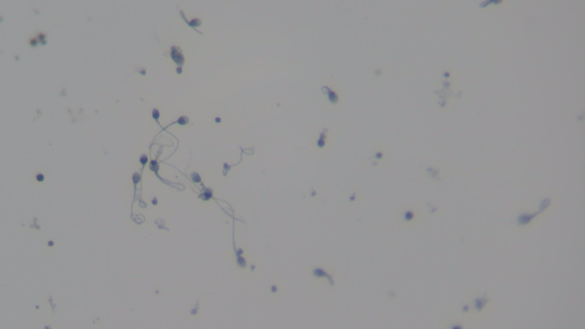 <p>What tissue is this</p>