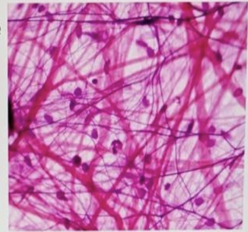 <p>identify the tissue</p>