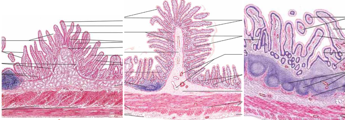 <p>what sections of the small intestine are these?</p>