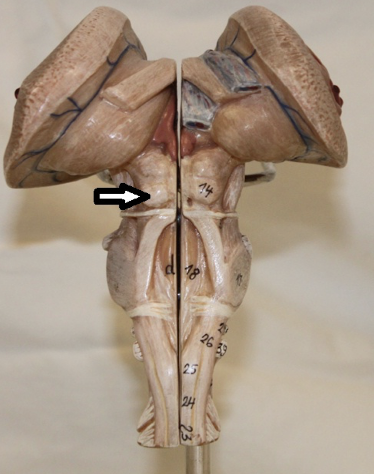 <p>identify the structure (bumps)</p>