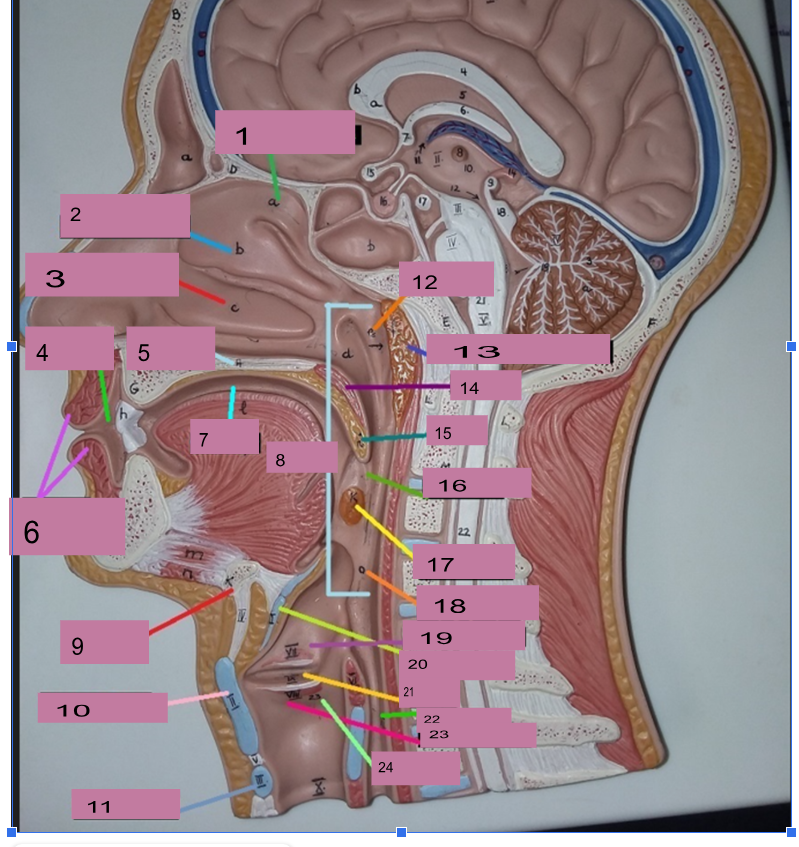 <p>What is number 1</p>