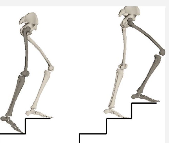 <ul><li><p>Foot Clearance to Foot Placement of Swing Phase</p></li><li><p>Hip Motion</p></li><li><p>Gluteus Medius</p></li><li><p>Concentric</p></li></ul><p></p>