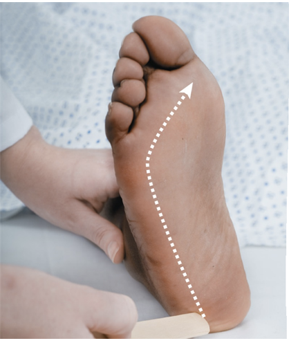 <p><span>Which reflex is being tested on this patient?</span></p><p></p>