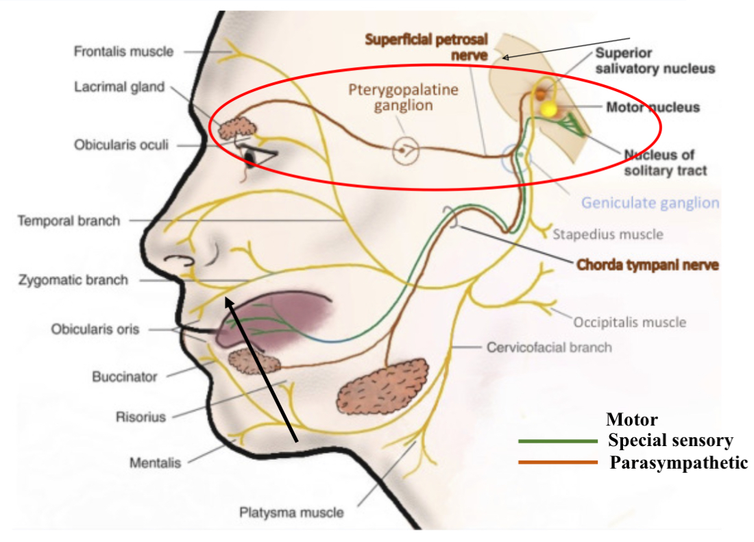 <p>In the pterygopalatin ganglion. </p><p>So parasympathetic nervous system is for rest and digest and efferents carry signals away from the brain to the target organ ( lacrimal glands). </p><p>The prepaying ganglion is a cluster of nerve cells located in deep face behind the maxilla. Acts as a relay station to connect to another nerve cell. </p><p>Basically nerve signals from the brain tell lacrimal gland to make tears travel through a parasympathetic pathway. </p>