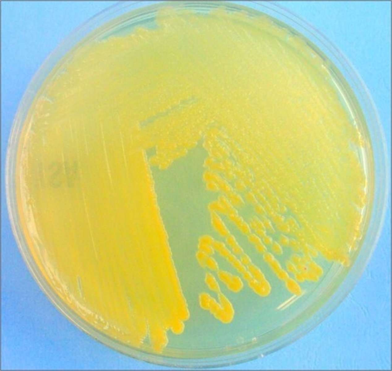 <p>Error in streaking:</p>