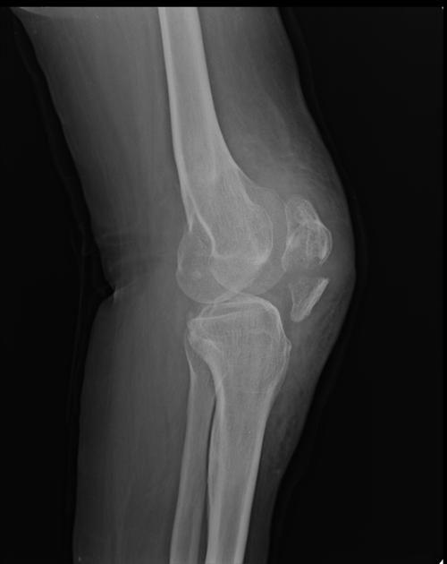 <p>Describe the abnormality demonstrated. </p>
