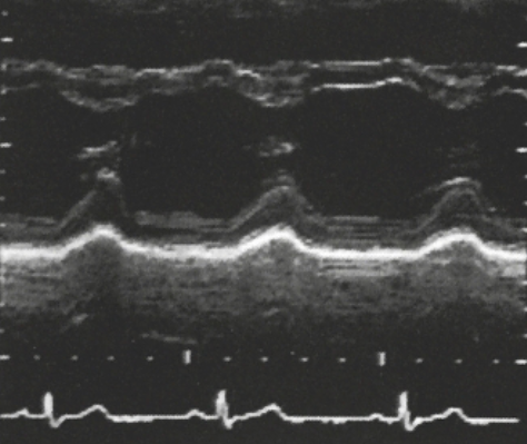 <p>Identify this image. </p>