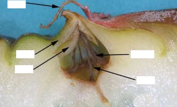 <p>Identify the structures in pineapple, a multiple fruit.</p>