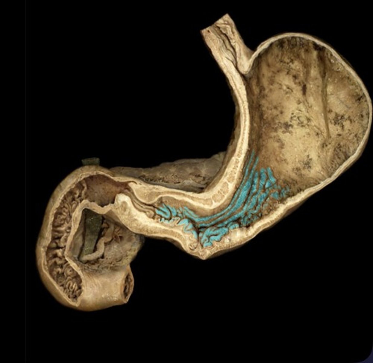 knowt flashcard image