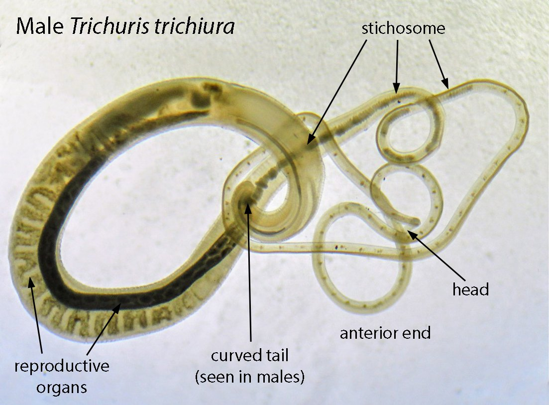 <p>Trichuris</p>