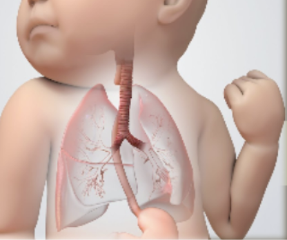 <p>What GI disorder is this?</p>