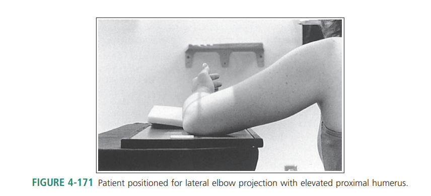 <ul><li><p>the distal capitulum surface is demonstrated too far distal to the distal surface of the medial trochlea and the radial head is placed too far posteriorly to the coronoid process</p></li><li><p>Proximal humerus is elevated&nbsp;</p></li></ul><p></p>
