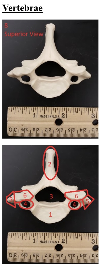 <p>5) name these bumpers</p>