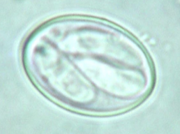 <p>What species does this sporocyst belong to? How large is it? </p>