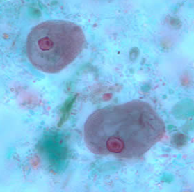 <p>Professor: Dr. Glena Fe A. Yapchulay-Alcabasa</p>