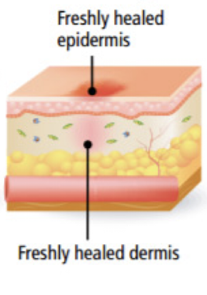 <p>What <strong>fourth phase</strong> of wound healing is <strong>collagen remodeled</strong> and realigned along tension lines and old cells removed by apoptosis? </p>