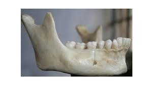 <p>name this bone or bone marking?</p>