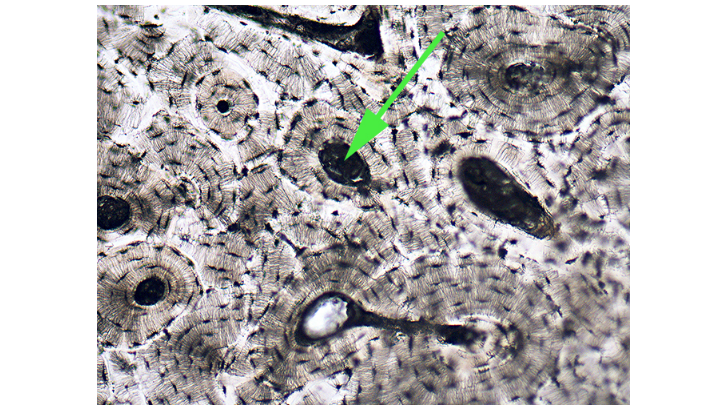 <p>What is the dark area in the bone tissue marked by the green arrow called?</p>