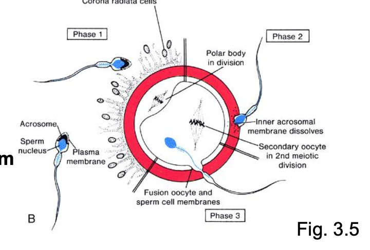 <p><strong>Capacitated sperm digest the zona pellucida, and the first to arrive at the oocyte membrane triggers a <u>cortical reaction</u>.</strong></p><ul><li><p>Fertilization</p></li><li><p>Capacitated</p></li><li><p>- corona radiata<br>- zona pellucida (acrosome reaction)</p><p>-oocyte membrane</p></li><li><p>soluble factors</p></li></ul><p></p>