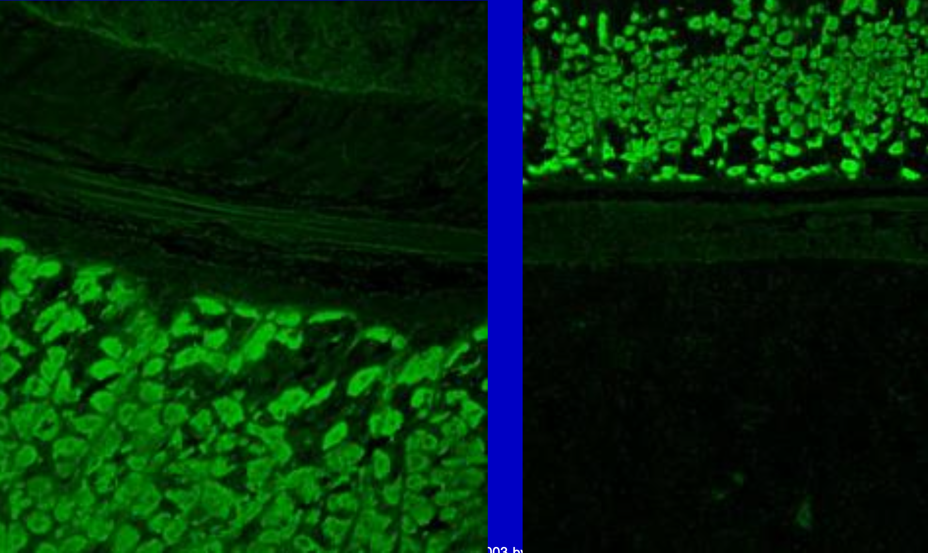 <p>Anti-Parietal Cell</p>