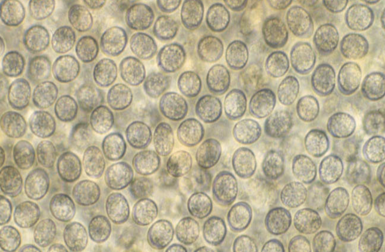 <p>What parasite do these oocysts belong to and how large are they? </p>