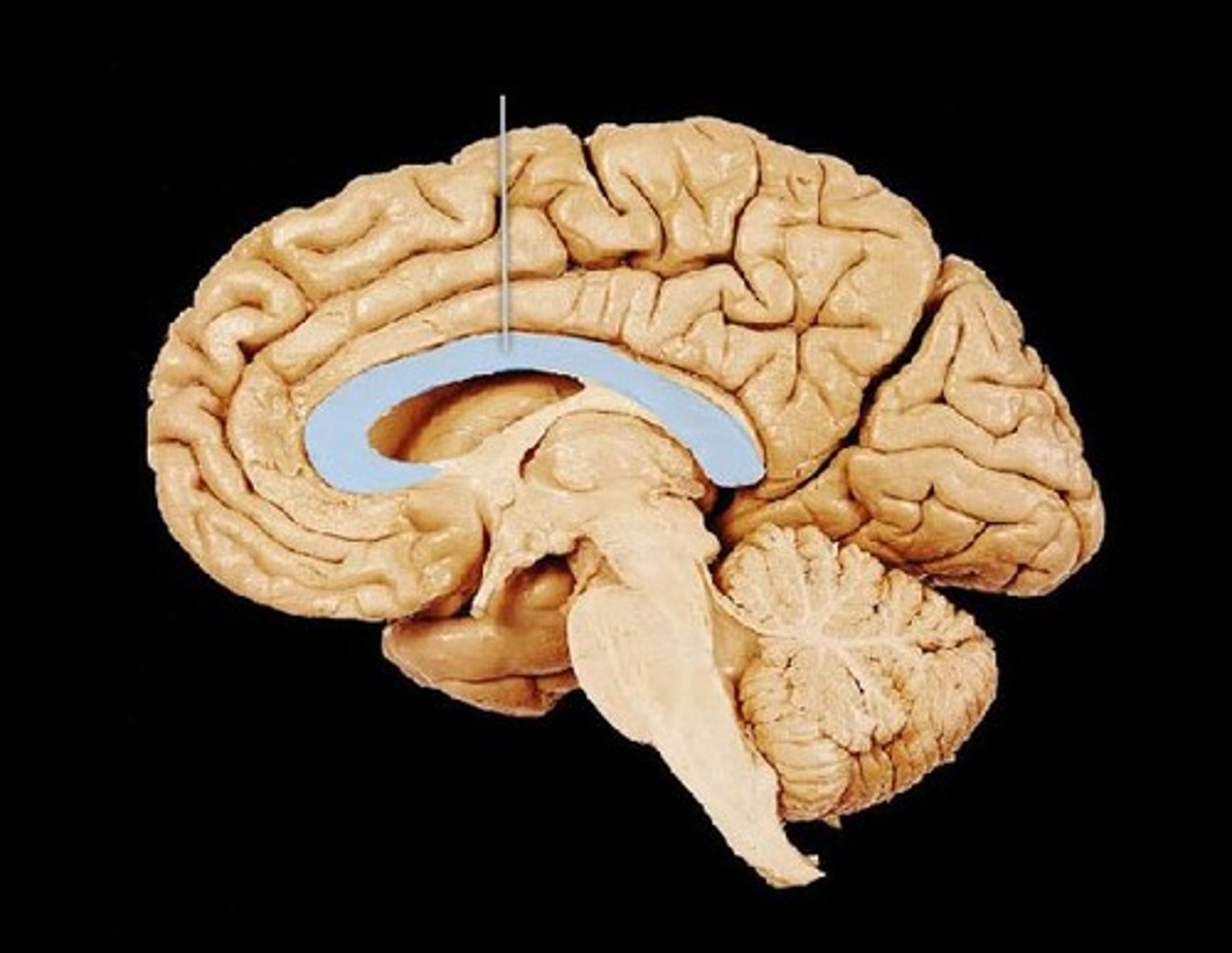 <p>wide band of neural fibers that connects the two hemispheres of the brain</p>