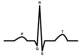 <p>Between R to T waves, what is this?</p>